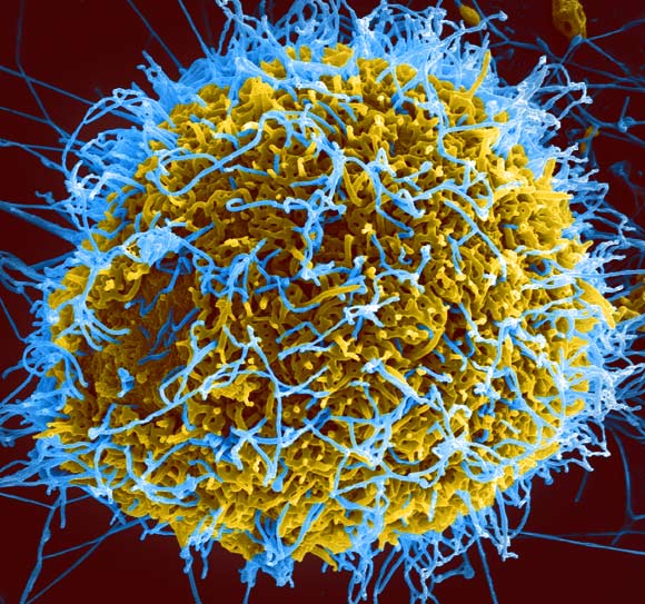 Colorized scanning electron micrograph of filamentous Ebola virus particles (blue) budding from a chronically infected cell (yellow). Image credit: NIAID / CC BY 2.0.