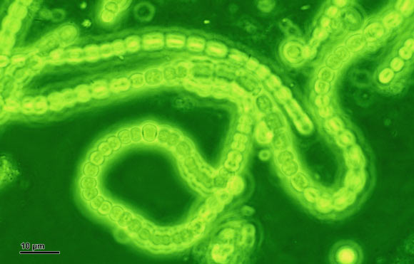 Cyanobacteria. Image credit: Josef Reischig / CC BY-SA 3.0.