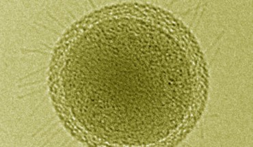 Colorized cryo-TEM image shows numerous hair-like appendages radiating from the surface of this ultra-small bacteria cell. Scale bar - 100 nm. Image credit: Birgit Luef et al.