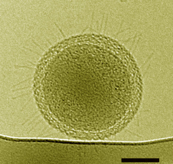 Colorized cryo-TEM image shows numerous hair-like appendages radiating from the surface of this ultra-small bacteria cell. Scale bar - 100 nm. Image credit: Birgit Luef et al.