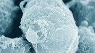 Colorized scanning electron micrograph of HIV-1, grown in cultured lymphocytes; virions are seen as small spheres on the surface of the cells. Image credit: C. Goldsmith.