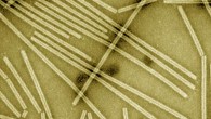 Transmission electron micrograph (false-color) of negatively stained SIRV2 particles. Image credit: Nicole Steinmetz et al.