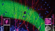 Image of a pair of engram (mCherry+) and nonengram (mCherry–) cells in the hippocampal dentate gyrus. Image credit: Tomás J. Ryan et al.