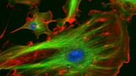 Until now, it was believed that chromosomes only played a passive role in animal cell division. Image credit: NIH.