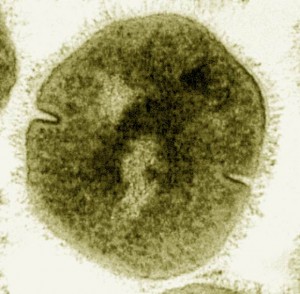 Scientists Discover New Dangerous Subtype of Streptococcus pyogenes ...