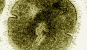 Streptococcus pyogenes under the electron microscope (false color). Image credit: Vincent Fischetti, Rockefeller University / CDC.