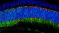 The ANC80 virus delivered genes to the mouse retina that fluoresce green when expressed. Pictured here, the delivered genes are active in the retina’s color-detecting cells. Image credit: Livia Carvalho.