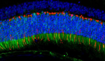 The ANC80 virus delivered genes to the mouse retina that fluoresce green when expressed. Pictured here, the delivered genes are active in the retina’s color-detecting cells. Image credit: Livia Carvalho.