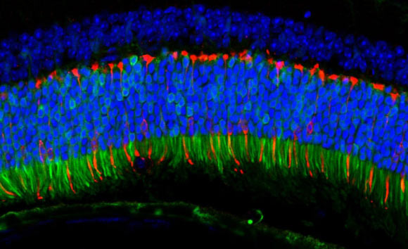 The ANC80 virus delivered genes to the mouse retina that fluoresce green when expressed. Pictured here, the delivered genes are active in the retina’s color-detecting cells. Image credit: Livia Carvalho.