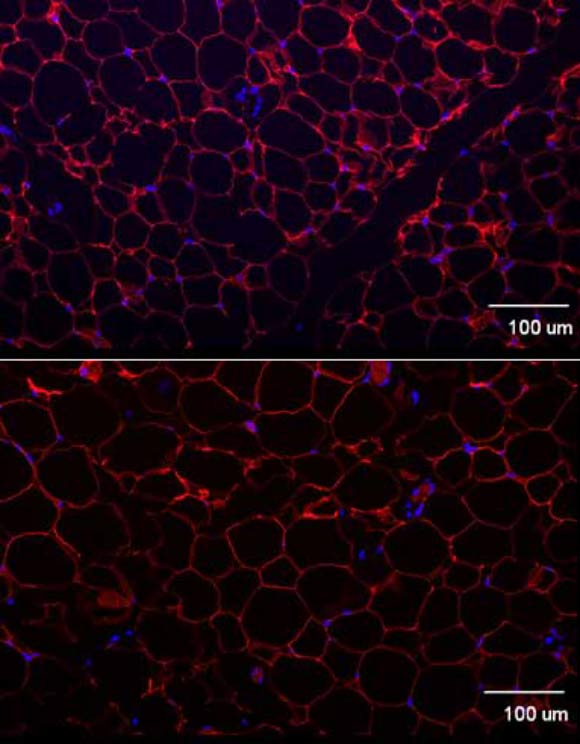 When the scientists silenced the ‘obesity gene’ in mice, it resulted in a 50% reduction in the amount of white fat (top vs. bottom image). Image credit: Gareth Lim.