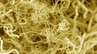 This false-color image shows carbon nanofibers. Image credit: Stuart Licht.