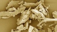 This false-color image shows household dust under a microscope. Image credit: NIAID.
