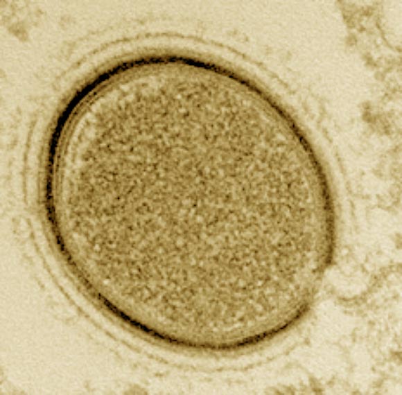 Mollivirus sibericum particle at a late assembly stage. The particle is crowned with several fuzzy rings, and different tegument layers are visible. Image credit: Matthieu Legendre et al.