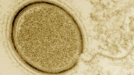 Mollivirus sibericum particle at a late assembly stage. The particle is crowned with several fuzzy rings, and different tegument layers are visible. Image credit: Matthieu Legendre et al.