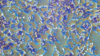 Bacillus subtilis. Image credit: Josef Reischig / CC BY-SA 3.0.