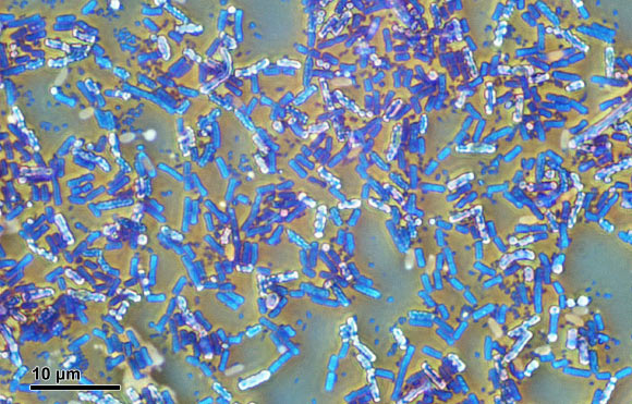 Bacillus subtilis. Image credit: Josef Reischig / CC BY-SA 3.0.