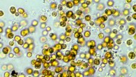 Symbiodinium kawagutii. Image credit: Scott R. Santos / Auburn University.