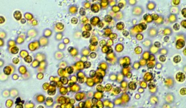 Symbiodinium kawagutii. Image credit: Scott R. Santos / Auburn University.