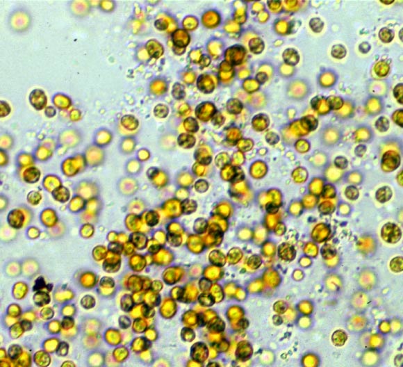 Symbiodinium kawagutii. Image credit: Scott R. Santos / Auburn University.