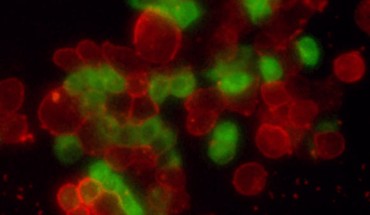 This image shows that high levels of active PCSK9 gene (green color) prevent LDL cholesterol (red color) from binding to the surface of liver cells. Image credit: Rockefeller University.