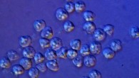 Fresh spores of the myxozoan species Kudoa iwatai; each spore is 10 micrometers in width. Image credit: A. Diamant.