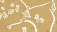 Nucleation of microdiamond from nanodiamond filaments which were quenched after the formation at 6,740 degrees Fahrenheit. Image credit: Jagdish Narayan / Anagh Bhaumik.