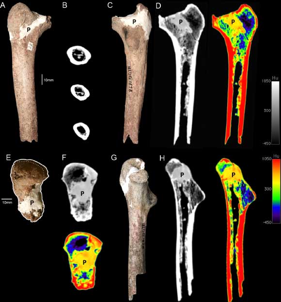 The Maludong femur: (a) anterior view; (b) CT-scan slices at subtrochanteric, approximate half-way and mid-shaft levels; (c) posterior view; (d) CT-scan slice at approximately mid-coronal plane, grayscale (left) and color density map (right); (e) superior view highlighting the overall outline and superior surface of the greater trochanter (anterior at left, lateral at top); (f) CT-scan transverse slices at approximate mid-neck level, grayscale (left) and colour density map (right); (g) medial view; (h) CT-scan slices in approximate mid-plane, grayscale (left) and color density map (right). Image credit: D. Curnoe et al.