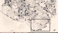 Electron microscopy of the bat cell line identifies viral particles that appear to be BGHV8: black and red boxes highlight enlarged regions directly below the image above; both areas identify budding and fully budded herpesvirus virions. Image credit: Reed S. Shabman et al.