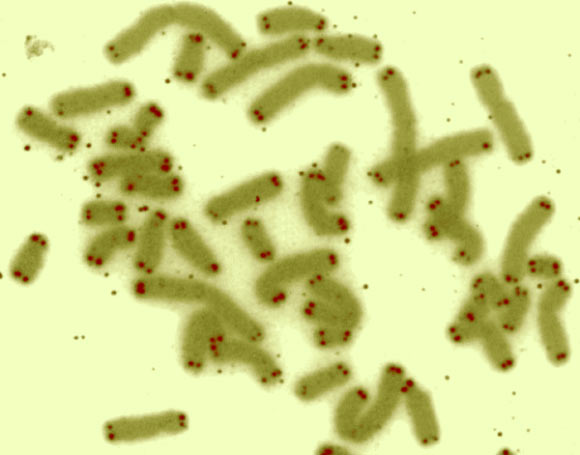 This false-color image shows human chromosomes (green) capped by telomeres (red). Image credit: U.S. Department of Energy Human Genome Program.