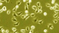 Image credit: Anthony Parenti et al.