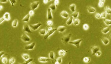 Image credit: Anthony Parenti et al.
