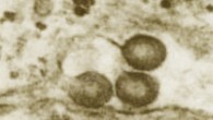 Retrovirus particles budding from rhesus macaque placenta cells. Image credit: Dorothy Feldman, via aacrjournals.org.