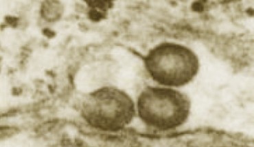 Retrovirus particles budding from rhesus macaque placenta cells. Image credit: Dorothy Feldman, via aacrjournals.org.