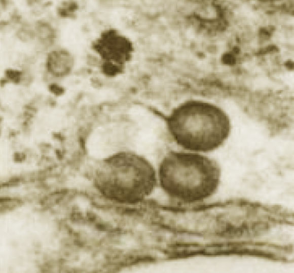 Retrovirus particles budding from rhesus macaque placenta cells. Image credit: Dorothy Feldman, via aacrjournals.org.
