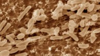 Ideonella sakaiensis. Image credit: Shosuke Yoshida et al.