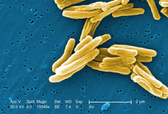Mycobacterium tuberculosis. Image credit: Janice Haney Carr / Centers for Disease Control and Prevention.