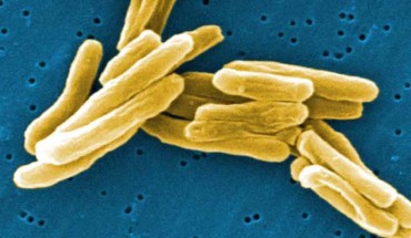 Mycobacterium tuberculosis. Image credit: Janice Haney Carr / Centers for Disease Control and Prevention.