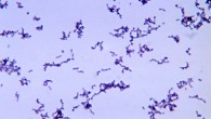 Propionibacterium acnes, a bacterium common in acne pustules. Image credit: Bobby Strong / CDC.
