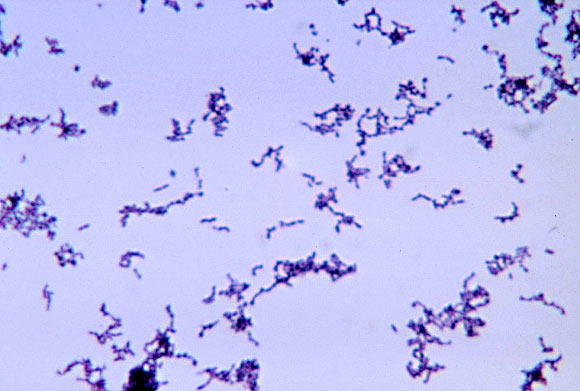 Propionibacterium acnes, a bacterium common in acne pustules. Image credit: Bobby Strong / CDC.