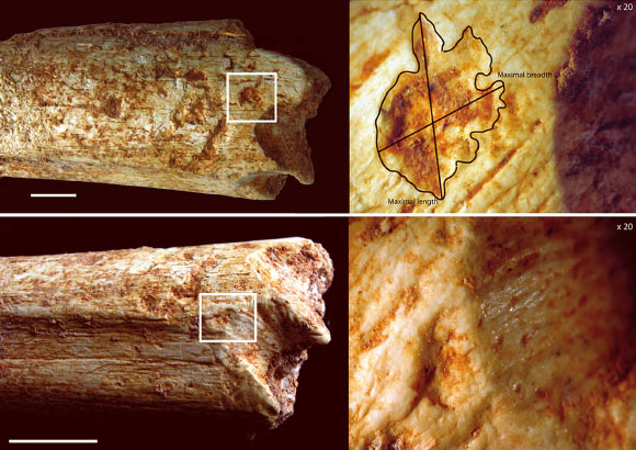 Carnivore marks on the distal end of the Homo heidelbergensis femur. Image credit: Camille Daujeard.