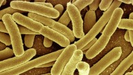 This false-color image shows Escherichia coli. Image credit: Geralt.
