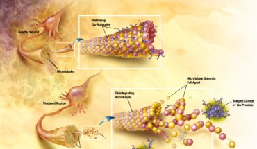 In AD, changes in tau protein lead to the disintegration of microtubules in brain cells. Image credit: Alzheimer’s Disease Education and Referral Center / National Institute on Aging.