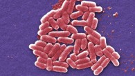 Escherichia coli. Image credit: Janice Haney Carr / CDC.