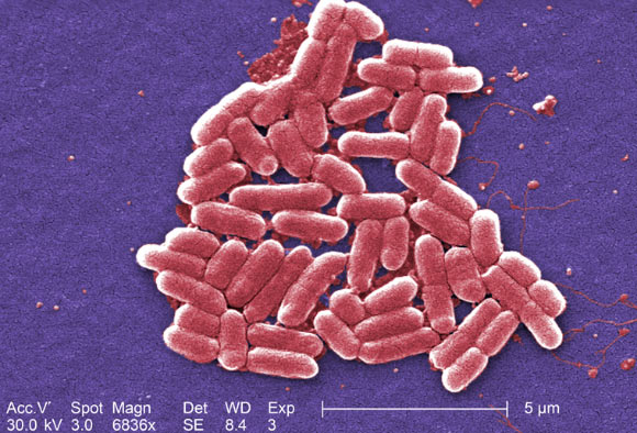 Escherichia coli. Image credit: Janice Haney Carr / CDC.