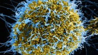Scanning electron micrograph of filamentous Ebola virus particles (blue) budding from a chronically infected cell (yellow-green). Image credit: NIAID.