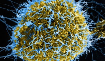 Scanning electron micrograph of filamentous Ebola virus particles (blue) budding from a chronically infected cell (yellow-green). Image credit: NIAID.