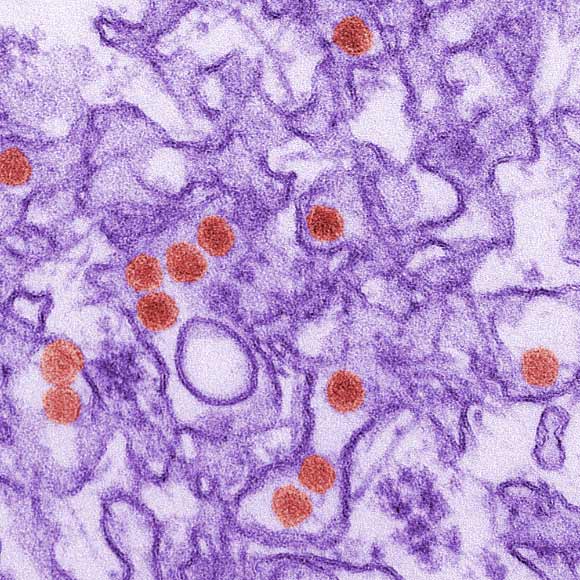 Transmission electron micrograph of Zika virus. Virus particles are 40 nm in diameter, with an outer envelope, and an inner dense core. Image credit: Cynthia Goldsmith / CDC.
