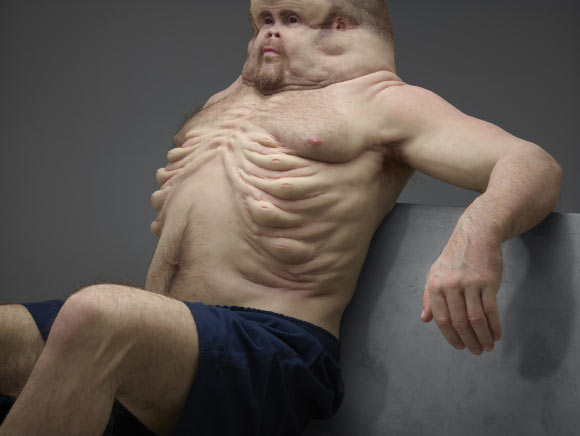 Graham’s ribs. Image credit: Transport Accident Commission of Victoria, Australia.