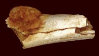 Image of the external morphology of a hominin foot bone (Paranthropus robustus or Homo ergaster) shows the extent of expansion of the primary bone cancer beyond the surface of the bone. Image credit: Patrick Randolph-Quinney.