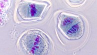 Meiosis: dividing pollen mother cells. Image credit: Josef Reischig / CC BY-SA 3.0.